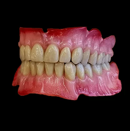 treatments-cosmetic.dentures-min