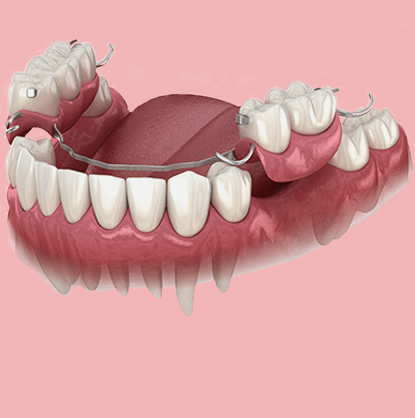 Untitled-5.prosthodontics.revise-min