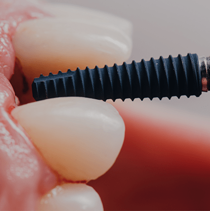 snapehill.treatment-thumb11-min