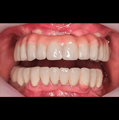 snapehill.treatments.allongfour-min